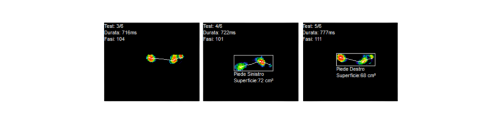 Analisi del passo con pedana baropodometrica per plantari su misura - Ortopedia Fontana